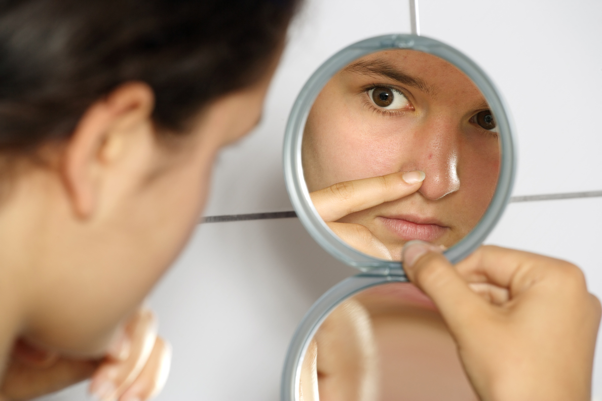 Curare l’acne: ecco cosa bisogna sapere per scegliere il giusto rimedio