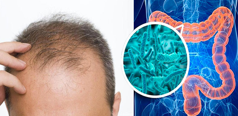 microbiota-alopecia